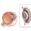 Ophthalmology