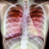 Pulmonary Disease